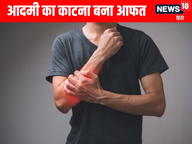 The thief bites the old man's hand, the doctor understood a minor wound, then what happened