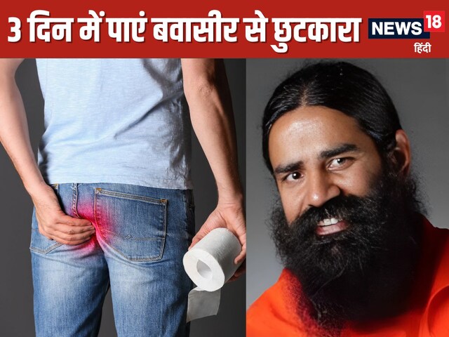 3 दिन में बवासीर जड़ से खत्म हो जाएगी ! बाबा रामदेव ने बताए अचूक नुस्खे