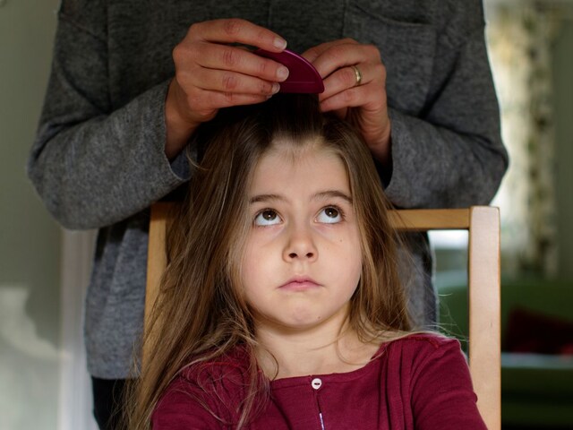 पैसे लेकर दूसरों के सिर से जुएं निकालती है लड़की, पागल समझते हैं लोग!