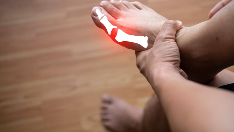 কুমড়ো এবং লাউয়ের মতো জলযুক্ত খাবার কিডনিকে অতিরিক্ত ইউরিক অ্যাসিড বের করে দিতে সাহায্য করতে পারে। আপেল, পেয়ারা, চেরি এবং পেঁপের মতো তাজা ফল বিশেষভাবে উপকারী। কম চর্বিযুক্ত দুধ এবং দইয়ের মতো দুগ্ধজাত পণ্যও স্বাস্থ্যকর ইউরিক অ্যাসিডের মাত্রা ধরে রাখে। বিশেষজ্ঞরা প্রতিদিন আট থেকে দশ গ্লাস জল পান করা এবং উষ্ণ লেবু জল দিয়ে সকাল শুরু করার পরামর্শ দেন। কুমড়ো এবং লাউয়ের মতো জলযুক্ত খাবার কিডনিকে অতিরিক্ত ইউরিক অ্যাসিড বের করে দিতে সাহায্য করতে পারে। আপেল, পেয়ারা, চেরি এবং পেঁপের মতো তাজা ফল বিশেষভাবে উপকারী। কম চর্বিযুক্ত দুধ এবং দইয়ের মতো দুগ্ধজাত পণ্যও স্বাস্থ্যকর ইউরিক অ্যাসিডের মাত্রা ধরে রাখে। বিশেষজ্ঞরা প্রতিদিন আট থেকে দশ গ্লাস জল পান করা এবং উষ্ণ লেবু জল দিয়ে সকাল শুরু করার পরামর্শ দেন।