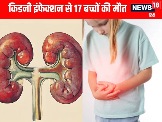छिंदवाड़ा में किडनी इंफेक्शन से अब तक 17 बच्चों की मौत, भेजे गए सैंपल छिंदवाड़ा में किडनी इंफेक्शन से अब तक 17 बच्चों की मौत, भेजे गए सैंपल