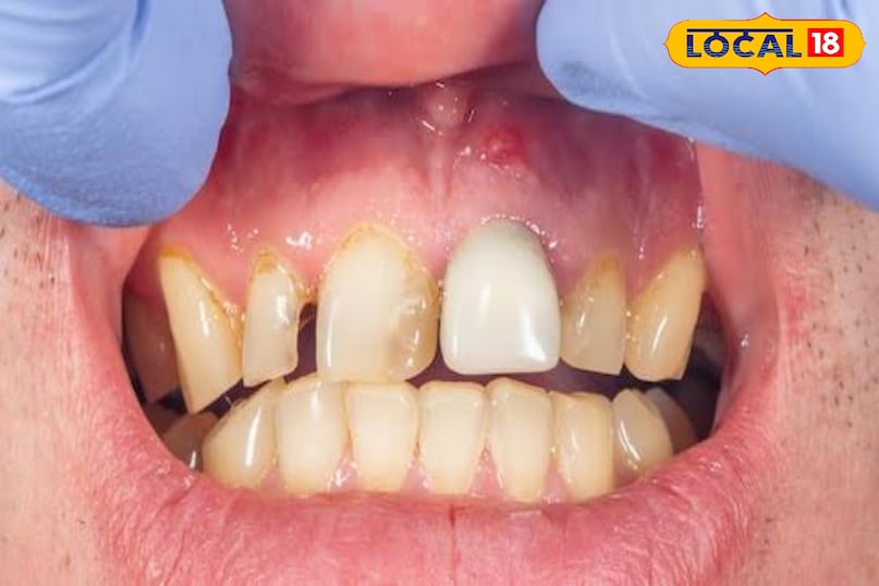 लोकल 18 लोकल 18