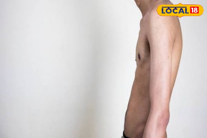 लोकल 18 लोकल 18