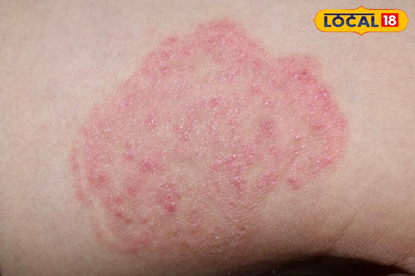 क्या करें, कैसे बचें