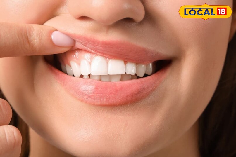 दांतों की देखभाल 