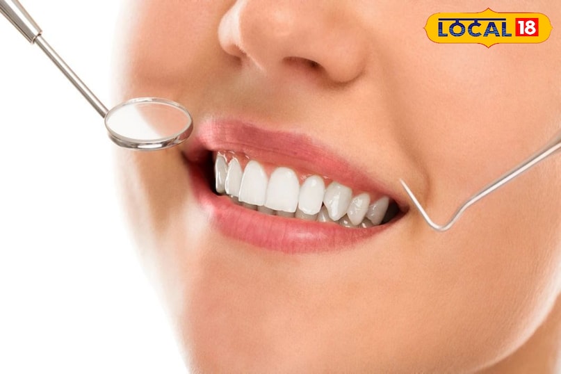 दांतों की देखभाल 