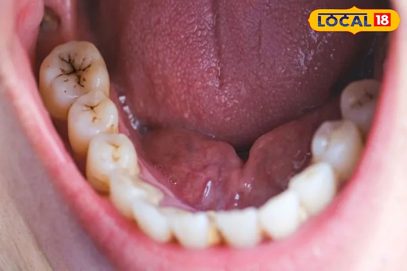 दांतों की देखभाल 