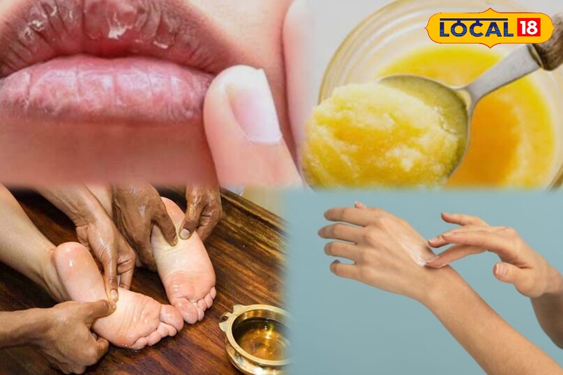सर्दियों में रूखी और फटी त्वचा? अपनाएं दादी-नानी का असरदार नुस्खा...