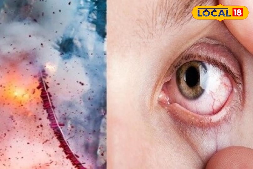 पटाखों से सावधान 