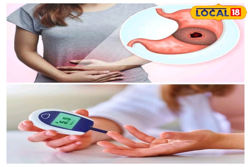 अल्सर अल्सर