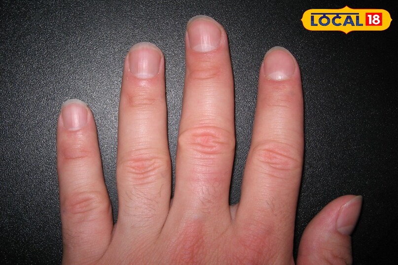 नाखून नाखून