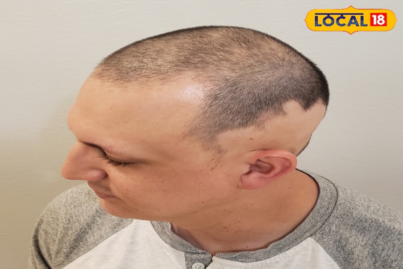 पोषक तत्वों की कमी से होता है ये रोग 