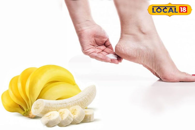 केले का पैक केला त्वचा को प्राकृतिक रूप से नमी और पोषण देता है। केले को मैश करके उसमें नारियल तेल या शहद मिला लें। इस पेस्ट को फटी एड़ियों पर लगाएं और 20-30 मिनट तक सूखने दें। सूख जाने पर पैरों को धो लें और मोज़े पहन लें। केले में मौजूद विटामिन और मिनरल्स त्वचा को फटने से बचाते हैं। केले का पैक केला त्वचा को प्राकृतिक रूप से नमी और पोषण देता है। केले को मैश करके उसमें नारियल तेल या शहद मिला लें। इस पेस्ट को फटी एड़ियों पर लगाएं और 20-30 मिनट तक सूखने दें। सूख जाने पर पैरों को धो लें और मोज़े पहन लें। केले में मौजूद विटामिन और मिनरल्स त्वचा को फटने से बचाते हैं।