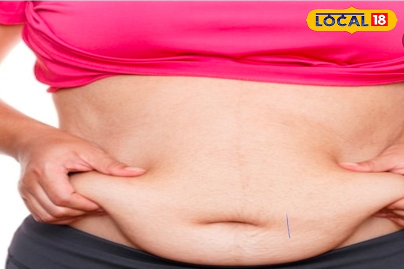 मोटापा  मोटापा