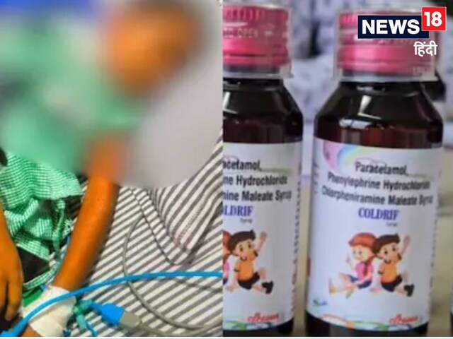जहर हैं ये 3 कफ सिरप, अब WHO ने दी वॉर्निंग, कहा-जहां कहीं दिखें, सूचना दें