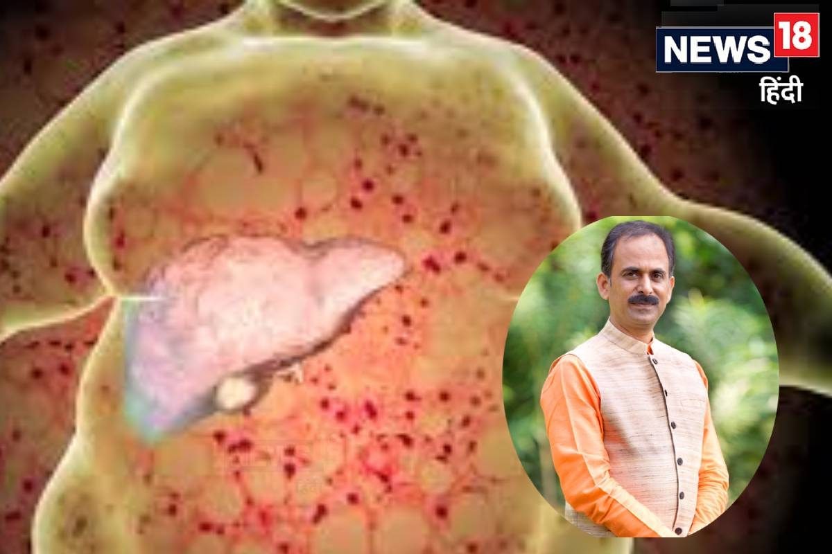 फैटी लिवर की छुट्टी! 4 हफ्तों में बॉडी होगी डिटॉक्स आचार्य मनीष ने बताया