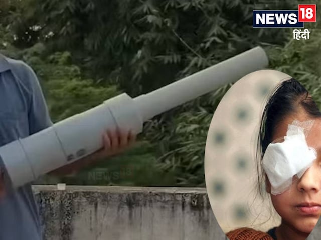 कार्बाइड गन से फूटी सैकड़ों आंखों की रोशनी वापस आएगी या नहीं? एम्स डॉ..... कार्बाइड गन से फूटी सैकड़ों आंखों की रोशनी वापस आएगी या नहीं? एम्स डॉ.....