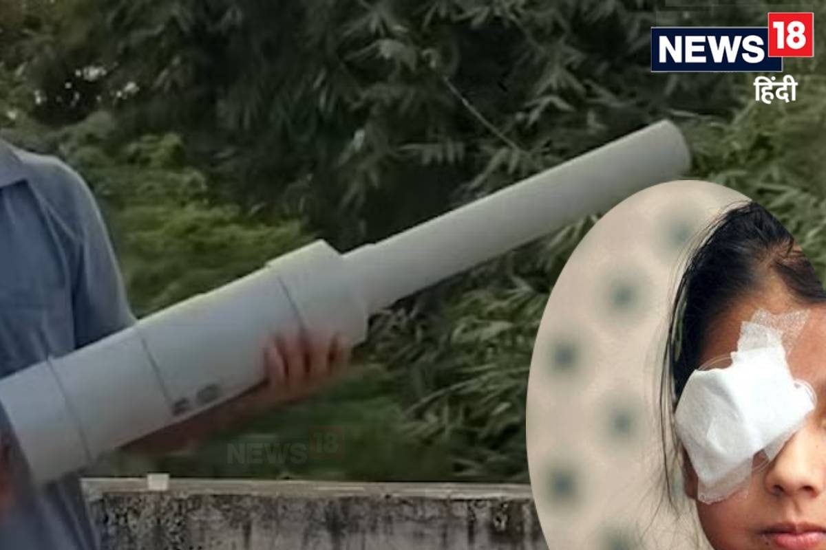 कार्बाइड गन या पटाखे किससे आंखों को ज्यादा हुआ नुकसान एम्स में आए 190