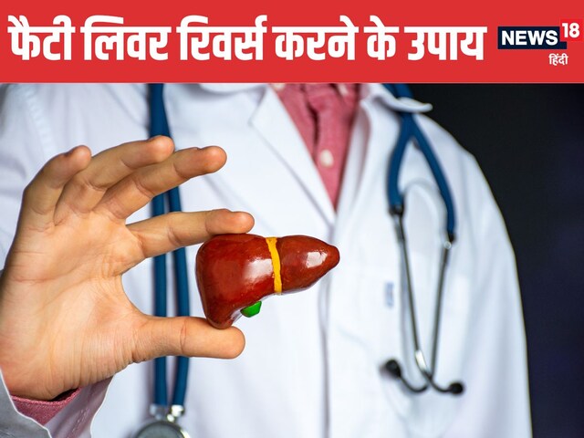 How to get rid of fatty liver problem? Doctor told 5 easy ways