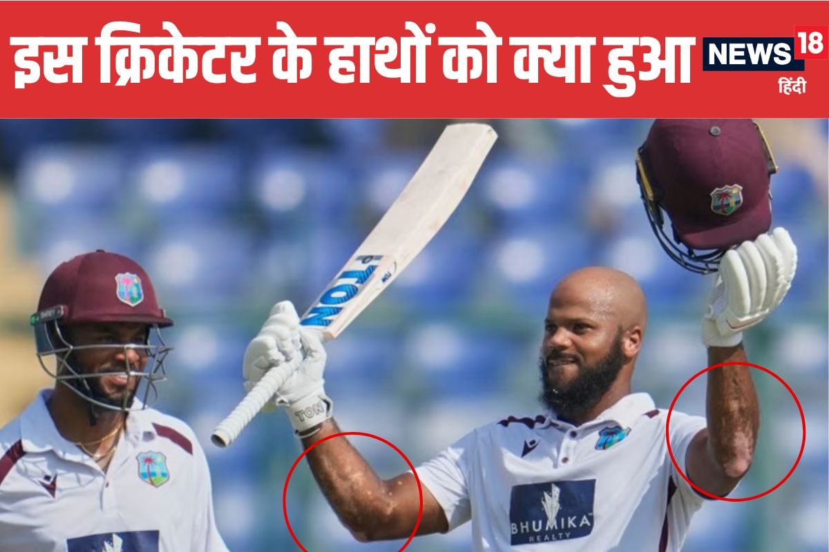 इस बीमारी से जूझ रहे भारत के खिलाफ शतक जड़ने वाले कैरेबियन बल्लेबाज कैंपबेल