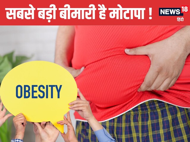 करीब 200 बीमारियों की जड़ है मोटापा ! भारत में तेजी से बढ़ रही यह समस्या