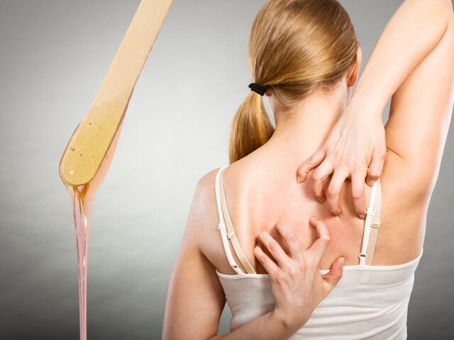 वैक्सिंग के बाद पीठ पर हो गए हैं दाने... लगाएं ये होममेड मास्क और इस पानी से.. वैक्सिंग के बाद पीठ पर हो गए हैं दाने... लगाएं ये होममेड मास्क और इस पानी से..