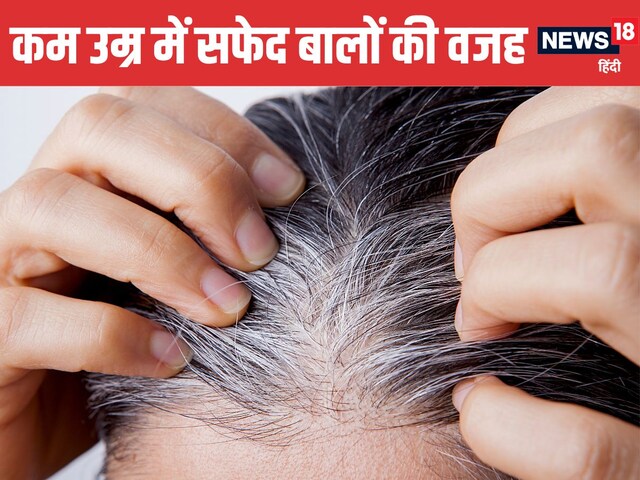 Health Quiz: किस विटामिन की कमी से सफेद होने लगते हैं बाल? किन फूड्स से मिलेगी भरपूर मात्रा, जानें काम की बात