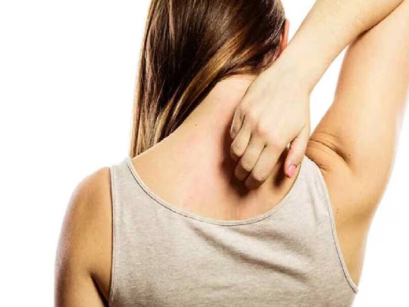 ত্বকে ঘন ঘন চুলকানি, শুষ্কতার একাধিক কারণ হতে পারে৷ বিশেষজ্ঞরা জানাচ্ছেন, যাঁদের ঘন ঘন শরীরের বিভিন্ন অংশ চুলকায়, বা যাঁদের ত্বক শুষ্ক থাকার প্রবণতা রয়েছে, তার অন্যতম প্রধান কারণ হতে পারে মাইক্রোনিউট্রিয়েন্টের ঘাটতি। বিশেষজ্ঞ জানাচ্ছেন, এমন ৫টি ভিটামিন রয়েছে, শরীরে যার ঘাটতির কারণে চুলকানি এবং শুষ্ক ত্বকের মতো সমস্যা হতে পারে। 