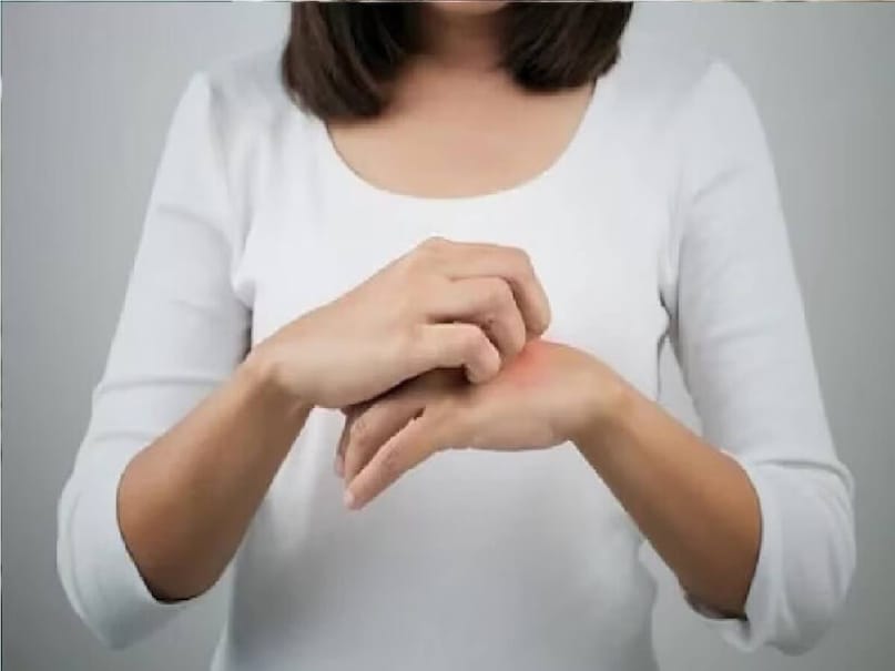 ভিটামিনের ঘাটতির কারণে চুলকানি, ত্বকে ফাটল এমনকী সংক্রমণের মতো সমস্যাও হতে পারে। ত্বকের উপরের স্তর বা এপিডার্মিস সঠিকভাবে কাজ করার জন্য পর্যাপ্ত হাইড্রেশন প্রয়োজন। চর্বি, প্রোটিন এবং জল ত্বককে নমনীয় এবং হাইড্রেটেড রাখতে কাজ করে।