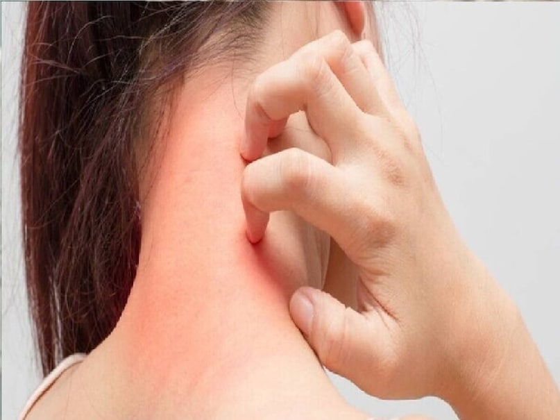 ত্বকের পুষ্টি এবং স্বাস্থ্যের জন্য শরীরের সর্বদা একটি সুষম খাদ্য প্রয়োজন। অতএব, এটি গুরুত্বপূর্ণ যে আপনি সর্বদা একটি সঠিক খাদ্য গ্রহণ করুন এবং খাদ্যতালিকাগত সম্পূরকগুলি সম্পর্কে আপনার চিকিত্সকের সাথে পরামর্শ করুন যা ঘাটতিগুলি পূরণ করতে সহায়তা করতে পারে।