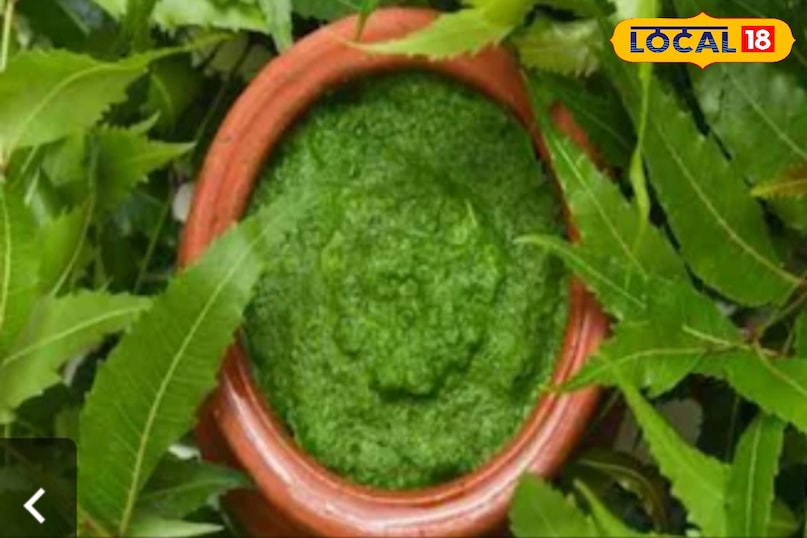 remedy for hair dandruff remedy for hair dandruff