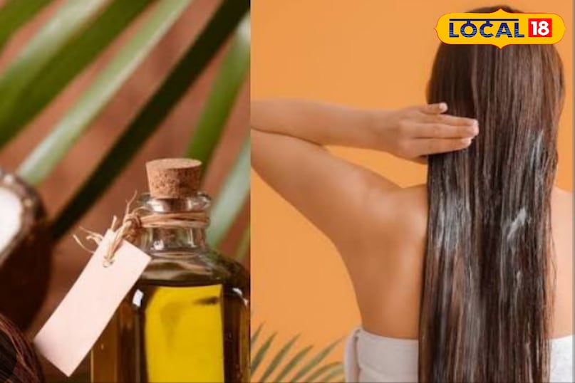 remedy for hair dandruff remedy for hair dandruff