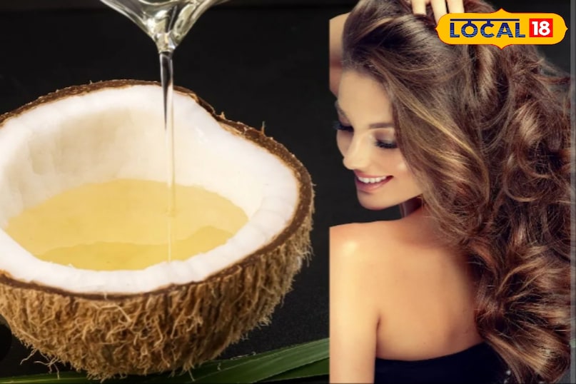 remedy for hair dandruff remedy for hair dandruff