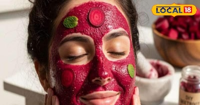 टैनिंग से छुटकारा