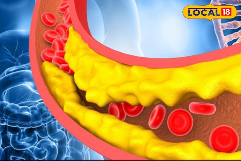 कोलेस्ट्रॉल पर नियंत्रण भिंडी में एक चिपचिपा पदार्थ होता है जो आंतों में जाकर खराब कोलेस्ट्रॉल LDL से चिपक जाता है और उसे शरीर से बाहर निकालने में मदद करता है। इससे दिल की सेहत अच्छी रहती है। 