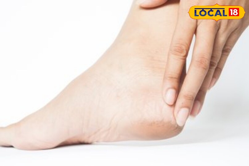 पैर धोने के बाद अच्छी तरह सुखाना चाहिए ताकि संक्रमण नही हो पैर धोने के बाद अच्छी तरह सुखाना चाहिए ताकि संक्रमण नही हो