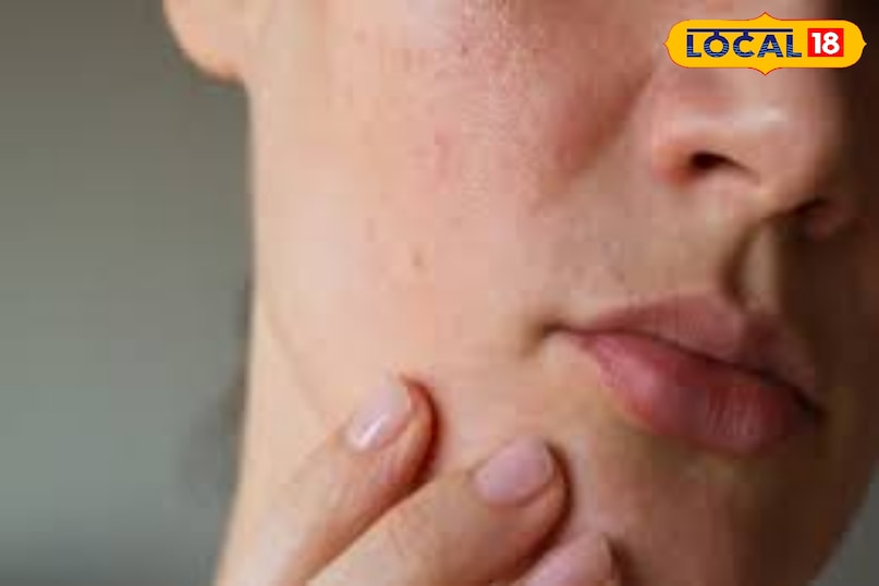 हल्के हाथों से चीनी और शहद स्क्रब करना चाहिए इससे होंठ की मृत त्वचा हटती है