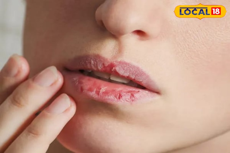 होंठों पर वैसलीन जरूर लगाएं.