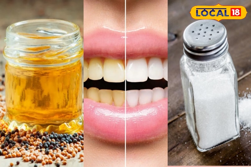 घरेलू नुस्खा घरेलू नुस्खा