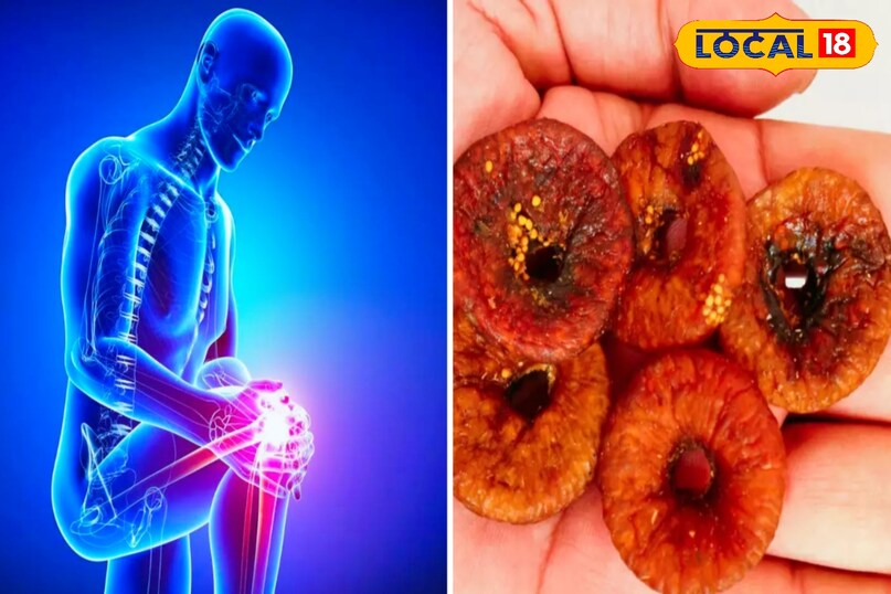 ठंड मे ऐसे चीजों का सेवन करे जिससे हड्डियां हो मजबूत ठंड मे ऐसे चीजों का सेवन करे जिससे हड्डियां हो मजबूत