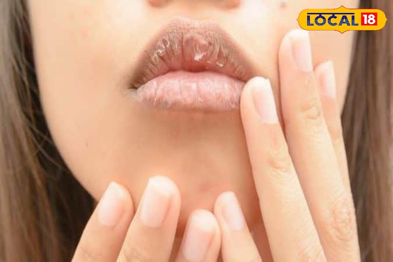 दादी नानी के नुस्खे