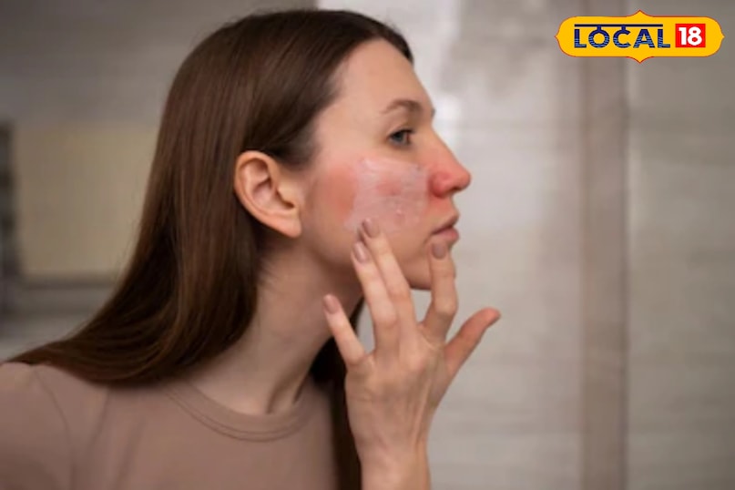 सर्द हवाओ मे त्वचा ज्यादा ड्राईनेस होने लगता है.