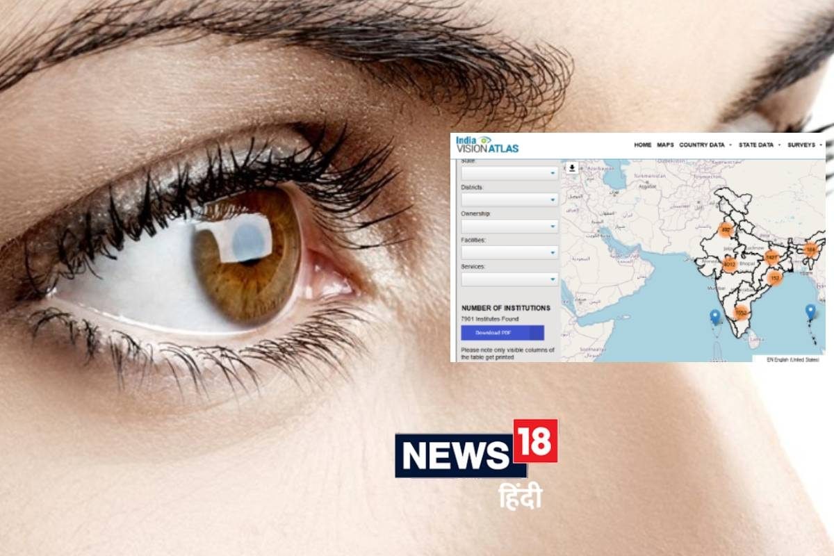 आंखों का ऑपरेशन कहां कराएं घर के पास कौन सा आई हॉस्पिटल है बस एक क्लिक पर