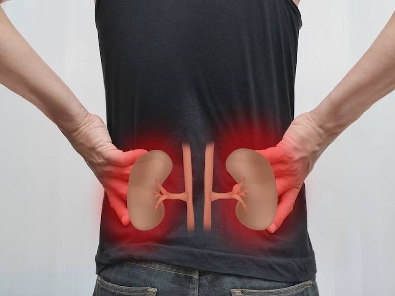 গ্লোমেরিউলোনেফরাইটিস--এই পরিস্থিতিতে কিডনিতে থাকা গ্লোমেরিউলিতে প্রদাহ সৃষ্টি হয়। তখন কিডনি দূষিত পদার্থ, ইলেকট্রোলাইট ও তরল ঠিকমতো ছাঁকতে পারে না, যা ধীরে ধীরে ক্রনিক কিডনি ডিজিজ-এর আকার নেয় এবং শেষপর্যন্ত দেখা দেয় কিডনি ফেলিওর। গ্লোমেরিউলোনেফরাইটিস--এই পরিস্থিতিতে কিডনিতে থাকা গ্লোমেরিউলিতে প্রদাহ সৃষ্টি হয়। তখন কিডনি দূষিত পদার্থ, ইলেকট্রোলাইট ও তরল ঠিকমতো ছাঁকতে পারে না, যা ধীরে ধীরে ক্রনিক কিডনি ডিজিজ-এর আকার নেয় এবং শেষপর্যন্ত দেখা দেয় কিডনি ফেলিওর।