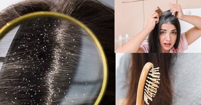 Beat Winter Hair Woes: Aloe Vera for Strong, Shiny Hair