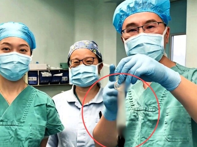 रेजर, स्ट्रॉ और फोन लाइट से सड़क पर सर्जरी, इन डॉक्टर्स की मुरीद हुई दुनिया