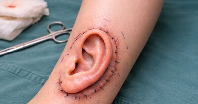 चीन के डॉक्टरों ने मेडिकल साइंस की दुनिया में किया चमत्कार(फोटो:Canva) 