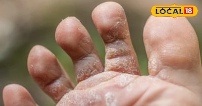 बड़े ही काम का है ये घरेलू उपाय