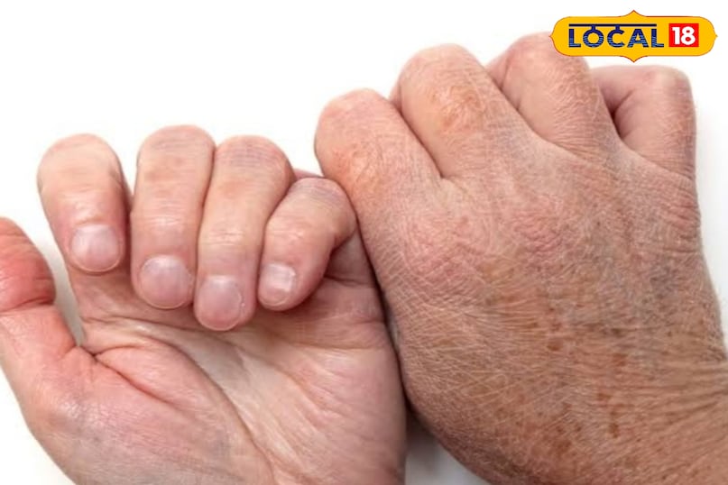 Beauty tips, winter tips, winter health tips, beauty parler at home, ghar ka Vaidya, घर का वैद्य, घर का इलाज, दादी-नानी के नुस्खे, घर के नुस्खे, Local 18, Bihar, Jamui