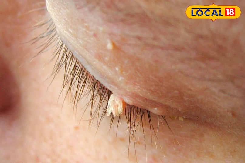 ब्यूटी टिप्स